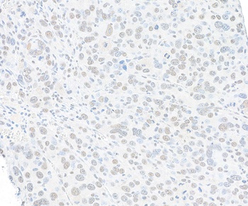 Rabbit anti-SMC1 Recombinant Monoclonal Antibody [BL-205-2G8]