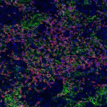 Rabbit anti-CD3E Recombinant Monoclonal Antibody [BL-298-5D12]