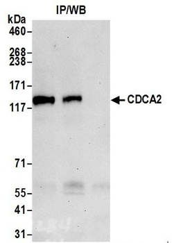 Rabbit anti-CDCA2 Antibody, Affinity Purified