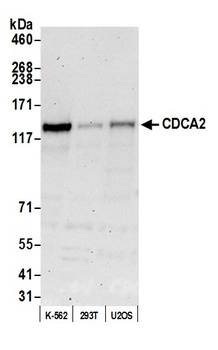 Rabbit anti-CDCA2 Antibody, Affinity Purified