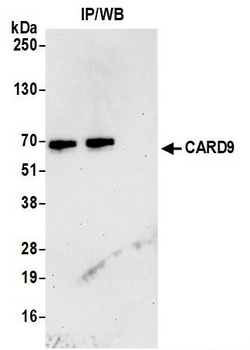 Rabbit anti-CARD9 Antibody, Affinity Purified
