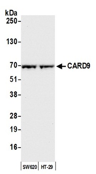 Rabbit anti-CARD9 Antibody, Affinity Purified