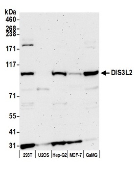 Rabbit anti-DIS3L2 Antibody, Affinity Purified
