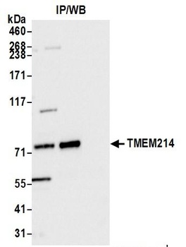 Rabbit anti-TMEM214 Antibody, Affinity Purified
