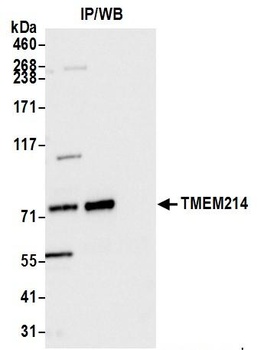 Rabbit anti-TMEM214 Antibody, Affinity Purified