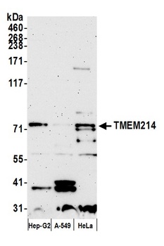 Rabbit anti-TMEM214 Antibody, Affinity Purified