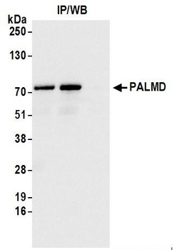 Rabbit anti-PALMD Antibody, Affinity Purified