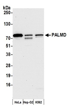 Rabbit anti-PALMD Antibody, Affinity Purified