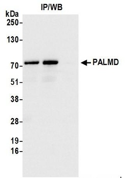 Rabbit anti-PALMD Antibody, Affinity Purified