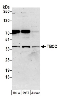 Rabbit anti-TBCC Antibody, Affinity Purified