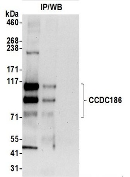 Rabbit anti-CCDC186 Antibody, Affinity Purified