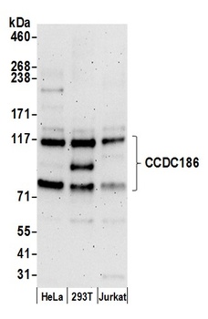 Rabbit anti-CCDC186 Antibody, Affinity Purified