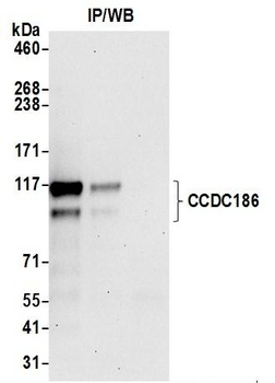 Rabbit anti-CCDC186 Antibody, Affinity Purified