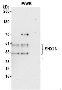 Rabbit anti-SNX16 Antibody, Affinity Purified