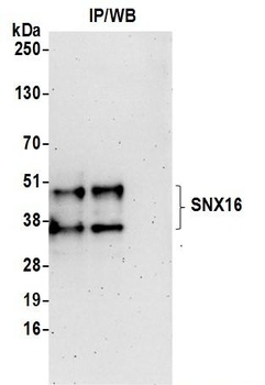 Rabbit anti-SNX16 Antibody, Affinity Purified