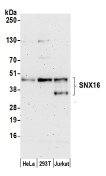 Rabbit anti-SNX16 Antibody, Affinity Purified