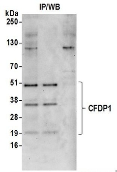 Rabbit anti-CFDP1 Antibody, Affinity Purified
