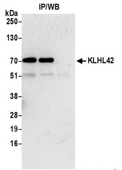 Rabbit anti-KLHL42 Antibody, Affinity Purified