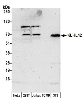Rabbit anti-KLHL42 Antibody, Affinity Purified