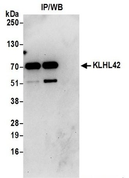 Rabbit anti-KLHL42 Antibody, Affinity Purified