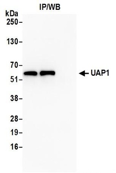 Rabbit anti-UAP1 Antibody, Affinity Purified