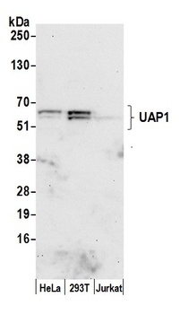 Rabbit anti-UAP1 Antibody, Affinity Purified