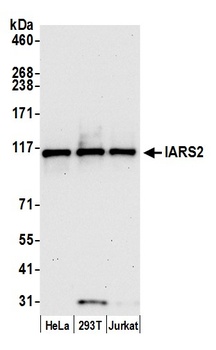 Rabbit anti-IARS2 Antibody, Affinity Purified
