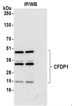 Rabbit anti-CFDP1 Antibody, Affinity Purified
