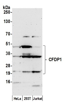 Rabbit anti-CFDP1 Antibody, Affinity Purified