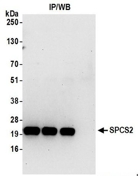 Rabbit anti-SPCS2 Antibody, Affinity Purified