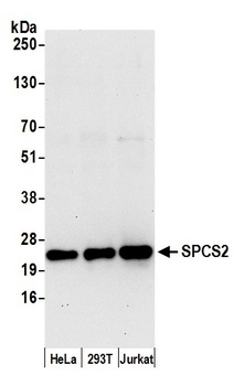 Rabbit anti-SPCS2 Antibody, Affinity Purified
