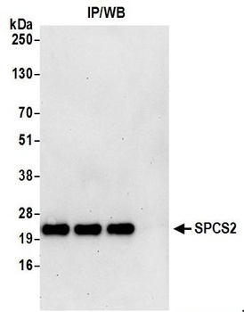 Rabbit anti-SPCS2 Antibody, Affinity Purified