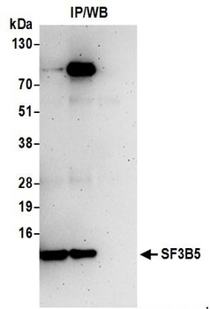 Rabbit anti-SF3B5 Antibody, Affinity Purified