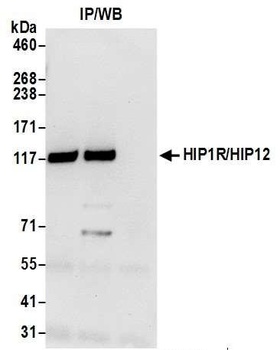 Rabbit anti-HIP1R/HIP12 Antibody, Affinity Purified