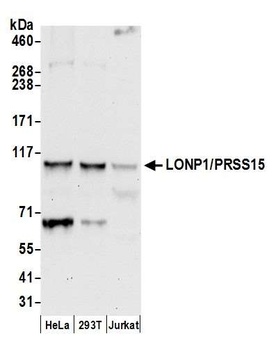 Rabbit anti-LONP1/PRSS15 Antibody, Affinity Purified