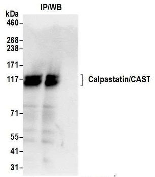 Rabbit anti-Calpastatin/CAST Antibody, Affinity Purified