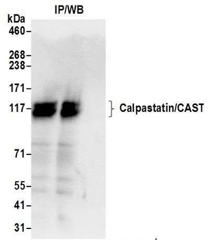 Rabbit anti-Calpastatin/CAST Antibody, Affinity Purified