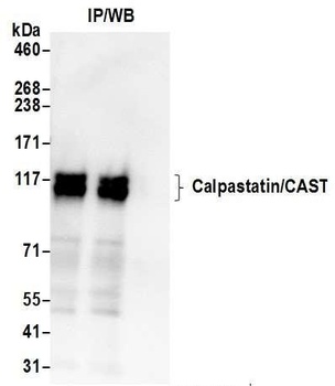 Rabbit anti-Calpastatin/CAST Antibody, Affinity Purified