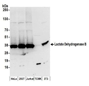 Rabbit anti-Lactate Dehydrogenase B/LDHB Antibody, Affinity Purified