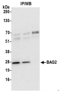 Rabbit anti-BAG2 Antibody, Affinity Purified