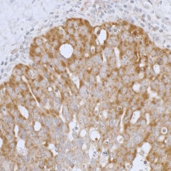 Rabbit anti-Peroxiredoxin-3 Antibody, Affinity Purified