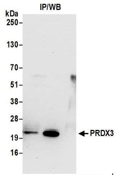 Rabbit anti-Peroxiredoxin-3 Antibody, Affinity Purified