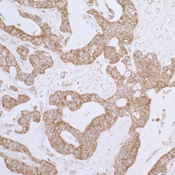 Rabbit anti-DLD Antibody, Affinity Purified