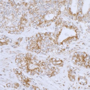 Rabbit anti-DLD Antibody, Affinity Purified
