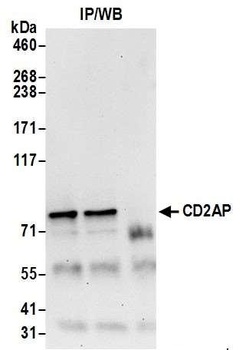 Rabbit anti-CD2AP Antibody, Affinity Purified