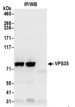 Rabbit anti-VPS35 Antibody, Affinity Purified