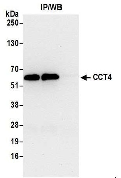 Rabbit anti-CCT4 Antibody, Affinity Purified