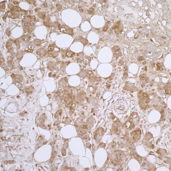 Rabbit anti-HSP27 Antibody, Affinity Purified