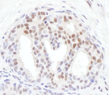Rabbit anti-Phospho Chk1 (S317) Antibody, Affinity Purified