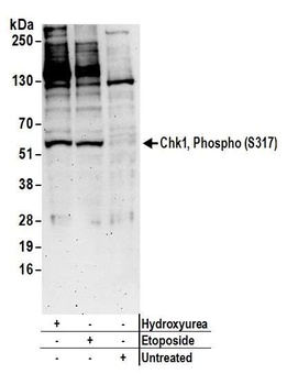 Rabbit anti-Phospho Chk1 (S317) Antibody, Affinity Purified